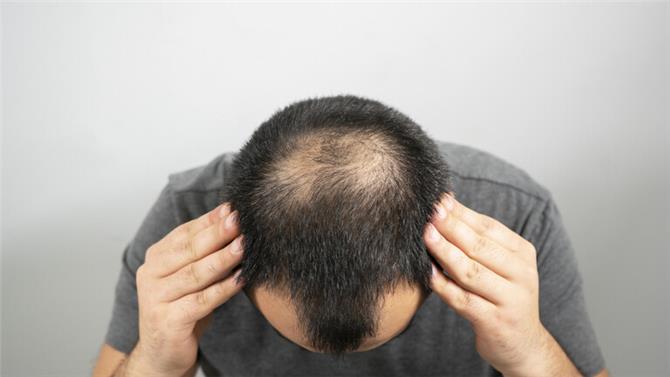 دواء شائع لعلاج تساقط الشعر وتضخم البروستات يظهر فائدة أخرى منقذة للحياة